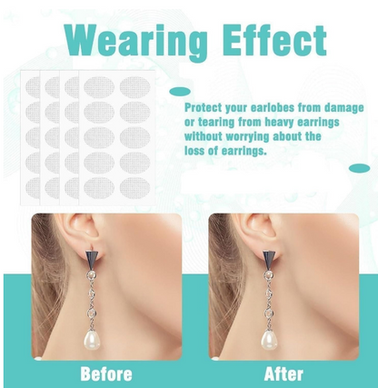 Premium Earlobe Support Patches (100 PCS)